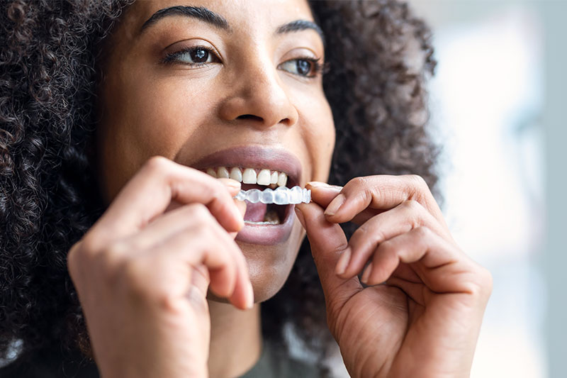 Clear Aligner Therapy in Torrance