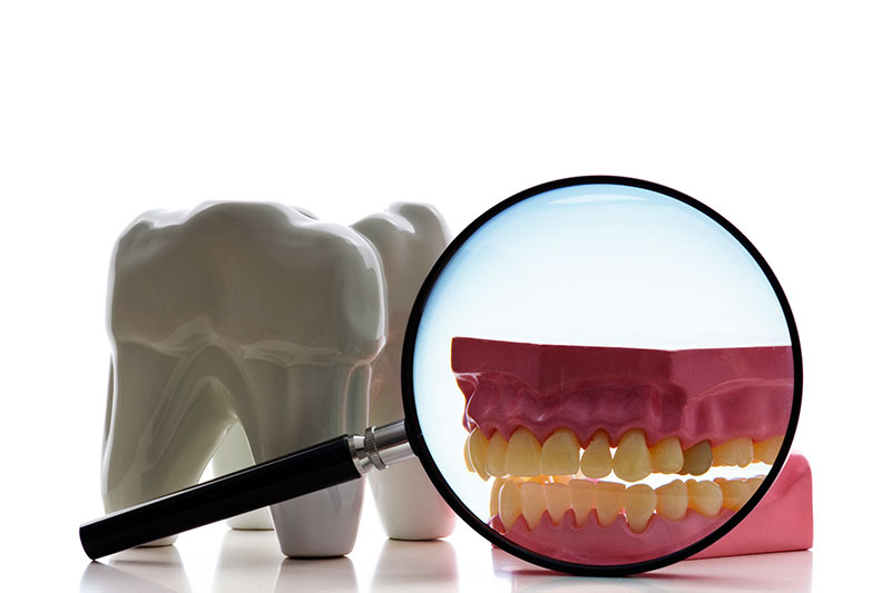 Root Canal Treatment in Torrance