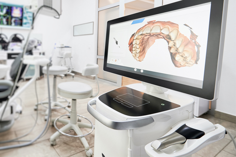 3D Mouth Scan in Torrance